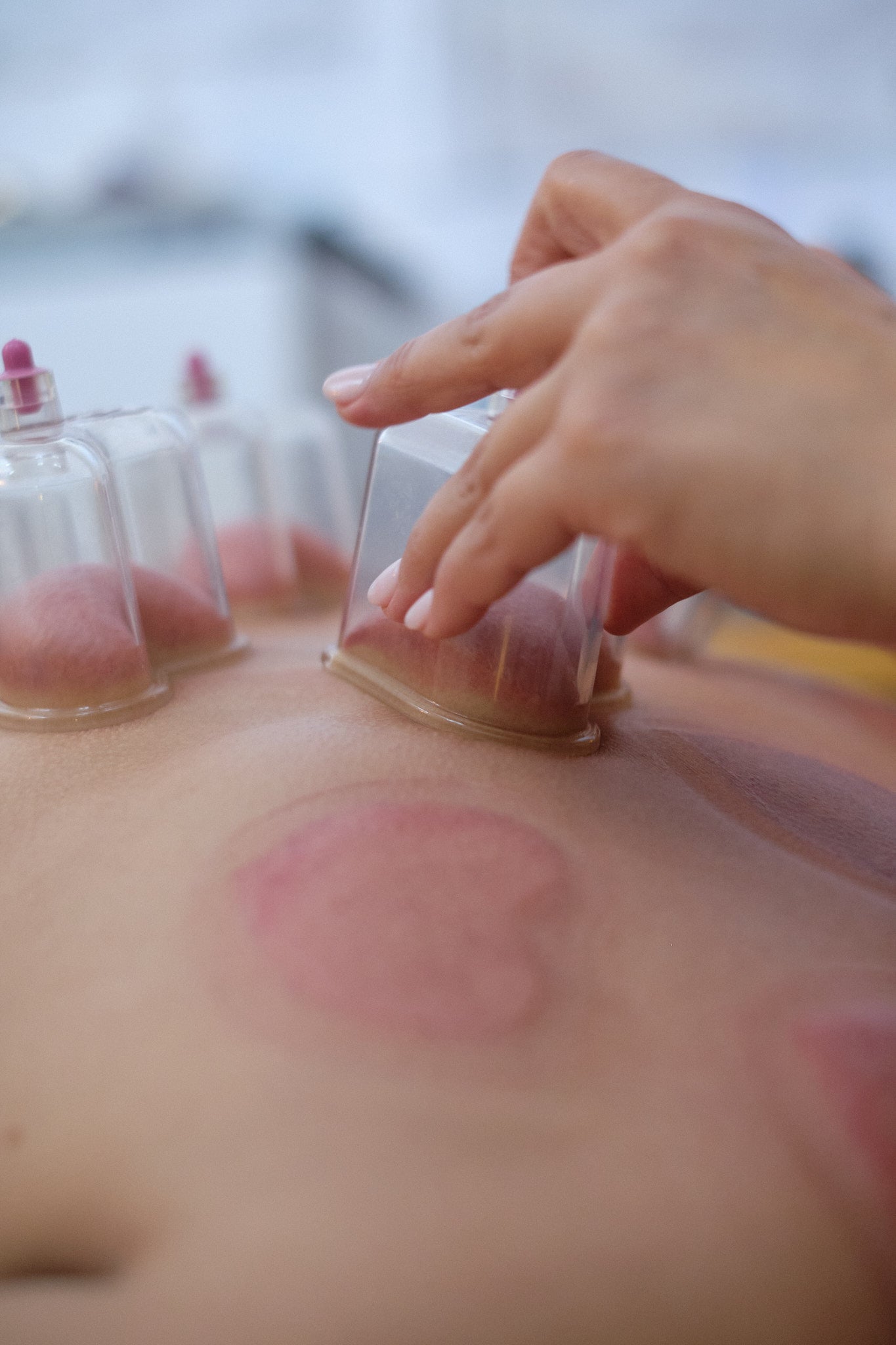 Love Cupping Summer Workshop August 16th 10:00-5:00PM
