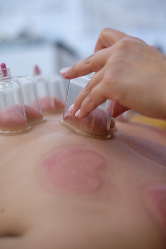 Love Cupping Summer Workshop June 7th 10:00-5:00PM
